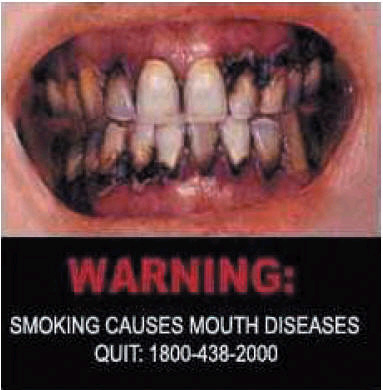 Singapore 2006 Health Effects mouth - mouth disease, diseased organ, gross